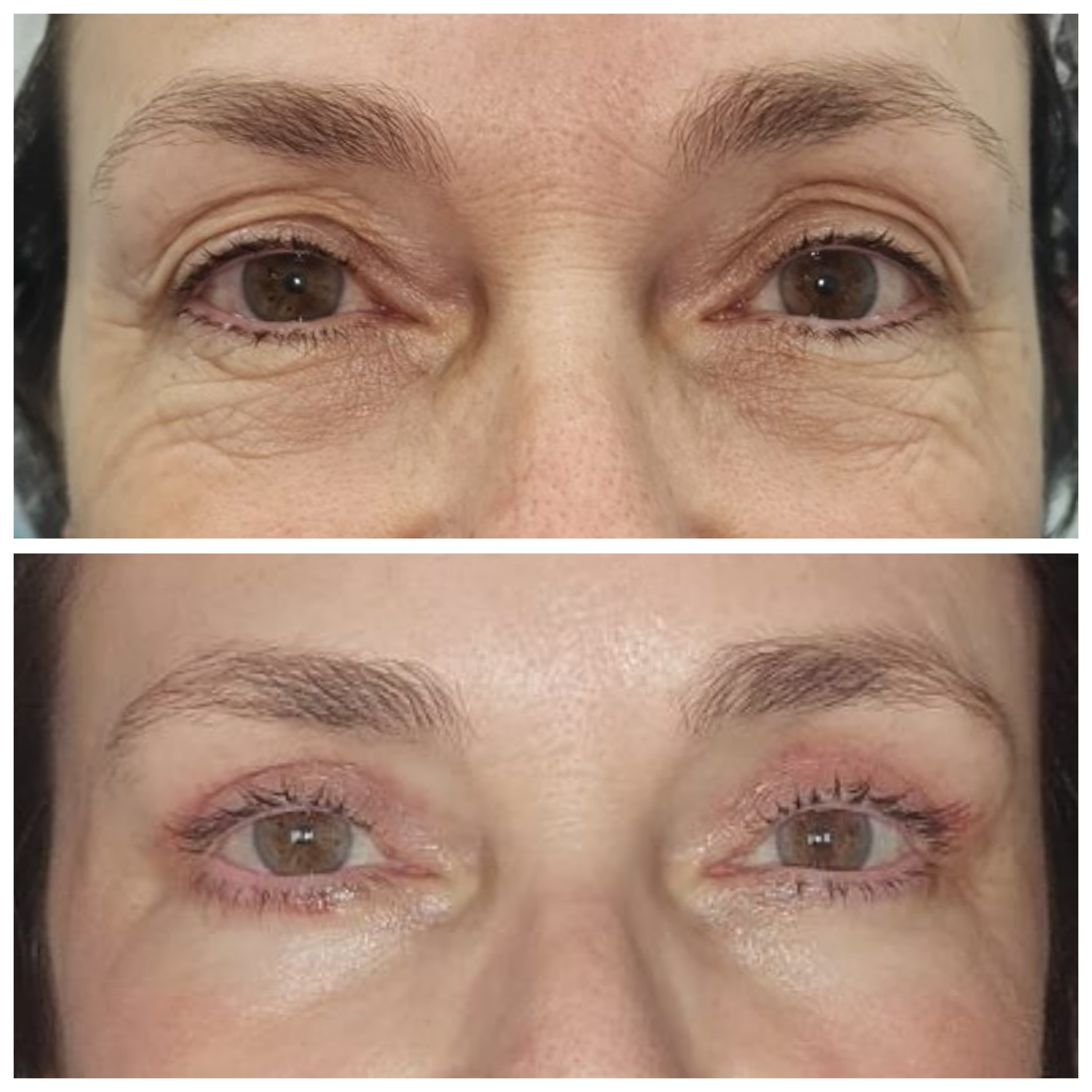 Paciente sorrindo após o procedimento